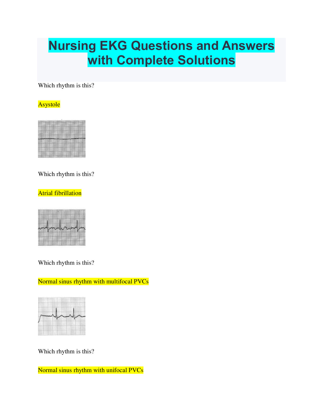 Nursing EKG Questions and Answers with Complete Solutions Browsegrades